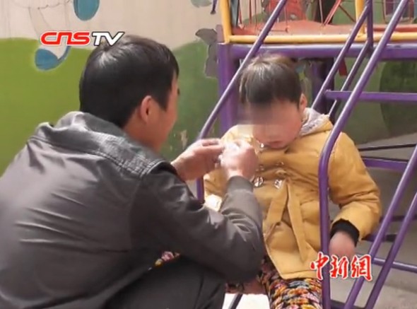 自闭症女童绳索5年情况好转 爱心人士慷慨救助